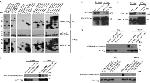 FIG 6 ZDHHC2 and ZDHHC19 interacted with nsP1 and mediate nsP1 palmitoylation. (A) Lysates from 293T cells transfected with 23 ZDHHCs fused to FLAGand GFP-nsP1 of CHIKV were immunoprecipitated with an anti-FLAG antibody and then immunoblotted with antibodi
