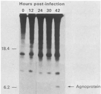 FIG.(~~~~infecteddescribedpercentagep.i.).withmutantmutantnuclear 3. Time courses of appearance of VP1 in the nuclei of cells