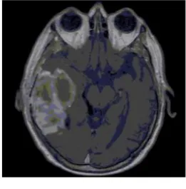 Fig. 6.1 Input image 