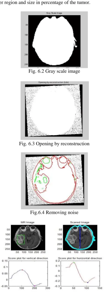 Fig. 6.2 Gray scale image                                     