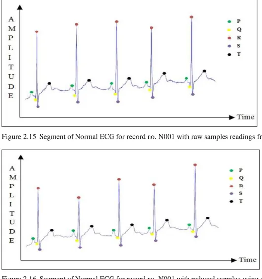 Figure 2.15. Segment of Normal ECG for record no. N001 with raw samples readings from Shimmer3 ECG dataset 