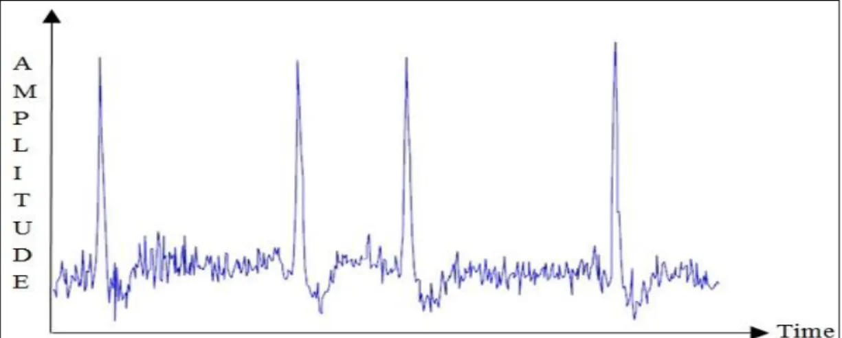 Figure 2.27. Segment of raw ECG for record no. 200 readings from MIT-BIH Arrhythmia database