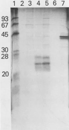 TABLE 1. RIA of s and pre-s antigen particles