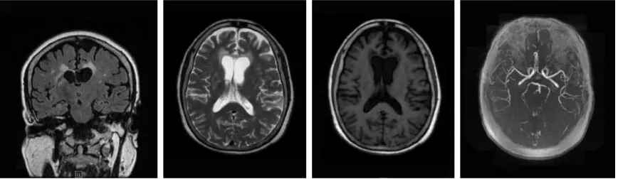 Figure 8. Before treatment.