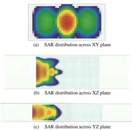Fig. 6.a   SAR distribution along a central line on the XZ plane containing tree block with RPW at 2cm from the leading edge of the 