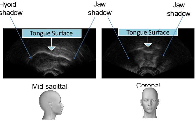 Figure 3: Ultrasound images in mid-sagittal and coronal view 