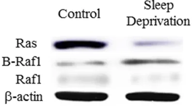 Figure 3. Ras, Raf-1, and B-Raf protein expression in hippocampus of rat. A: Expression of Ras protein in two groups; peated three times)