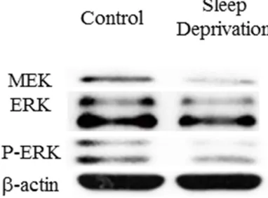 Figure 5. Expression of MEK1/2, ERK1/2, p-ERK1/2 proteins in hippocam-pus of rat. A: MER protein expression in the two groups of rats; B: ERK protein expression in the two groups; C: p-ERK protein expression in the two groups; D: p-ERK and ERK ratio in the