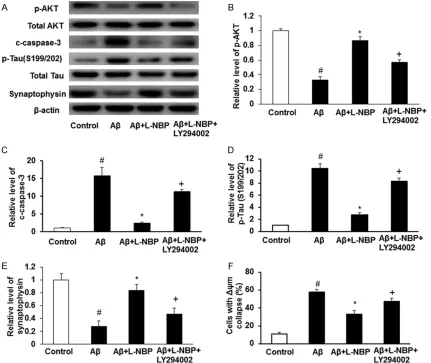 Figure 4. LY294002 can block the beneficial effects of L-NBP. A. Western blots analysis showed the expression of c-caspase-3, p-Tau, p-AKT, and synaptophysin