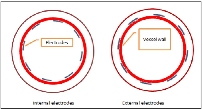 Figure 1.1: Internal and external electrodes installation 