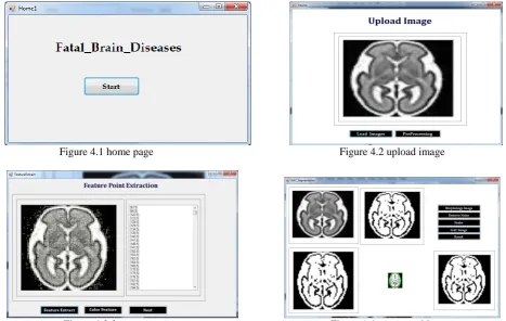 Figure 4.3 feture extract                                                            Figure 4.4 segmented image 
