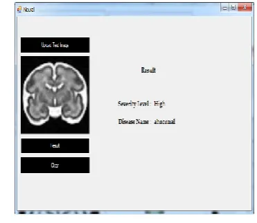 Figure 4.5 resulted image                                      Figure 4.6 resulted image 