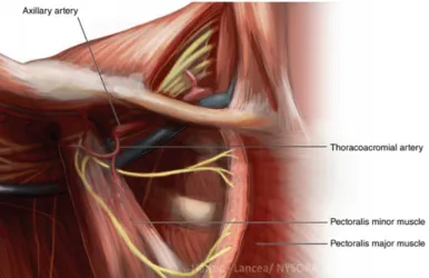 Figure 5 : (NYSORA) 