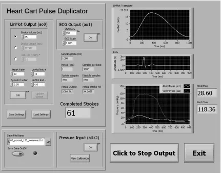 Figure 2. Heart Cart software GUI 