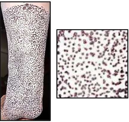 Figure 3. Zinc powder and black marker speckle pattern used on the anterior surface of the human forearm for in vivo DIC analysis of wrist extension (Modified from Omkar et al., 2013)