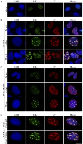FIG 1 SV40 host range mutants are defective for viral replication center formation. (A to D) Immuno-ﬂuorescence staining of mock-infected U2OS-ctrl (A), SV40 WT-infected U2OS-ctrl (B), SV40 HR684-infected U2OS-ctrl (C), and SV40 WT-infected or SV40 HR684-i