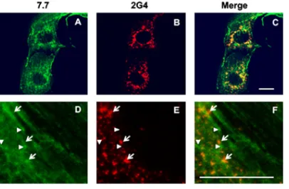FIG 1 VP4 is expressed both within virions and as a free protein. MA104 cells were infected by rotavirusRF stain and analyzed by confocal microscopy and immunoﬂuorescence at 6 h postinfection (h.p.i.) usingtwo different monoclonal antibodies