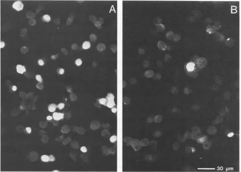 FIG. 5.(B)antibody Effect of IFN on the expression of HSV-1 a-protein ICP4. Untreated cells (A) or cells pretreated with 1,000 IU of IFN-P per ml were infected with HSV-1 at an MOI of 6
