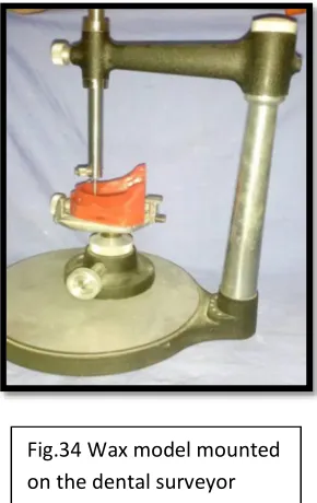 Fig.34 Wax model mounted 