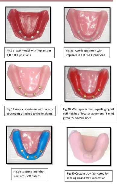 Fig.35  Wax model with implants in 
