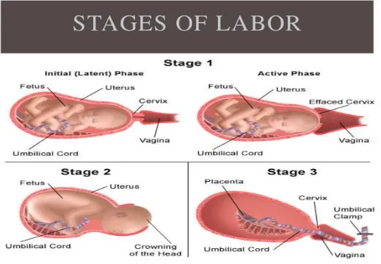 Fig. 1 Stages of labor 