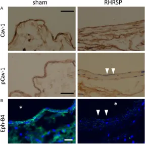 Figure 4. Endothelial p-Cav-1 and Eph-B4 was diminished in jugular veins of RHRSP group (n=5)
