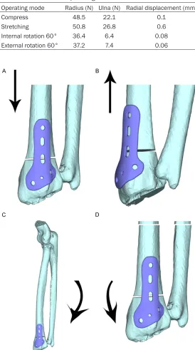 Table 2. Stress distribution and displacement on radius and ulna under the loads of all operating conditions
