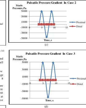 Fig. 4. Figure of pulsatile pressure gradient of vein graft model (a) Ideal; (b) (d) Case 1; (c) Case 2; (d) Case 3 From our observation on pulsatile pressures at proximal and 
