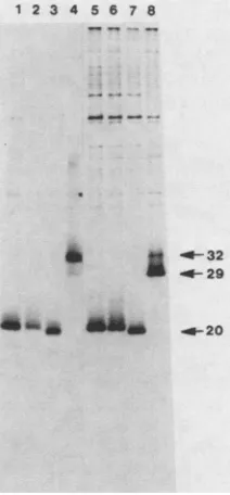 FIG. withoJC119 alonev_SiS132, orinserted into(A) Samplessamples ana-indicate thethe dimericform pthe(lanev-sis, piroductsproductsatmutant genes indicate theluctsbetweenproductsanalyzedlyzeddimericapproximatelyv-sis' i SV40 of( under genes protein 3