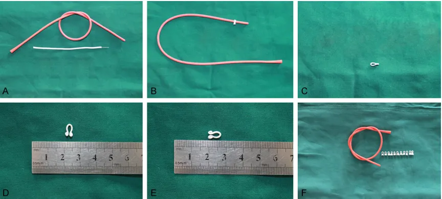 Figure 1. Preparation of the atraumatic intestinal clamp. A: A 10 Fr bladder catheter was used for simulating the distal ileum intestine (similar diameter)