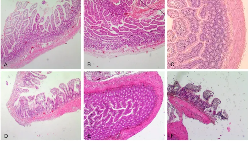 Figure 4. Pathological sections of intestines at the obstruction sites. A-F: I6, I12, I24, I48, I72 and I96 groups, re-spectively