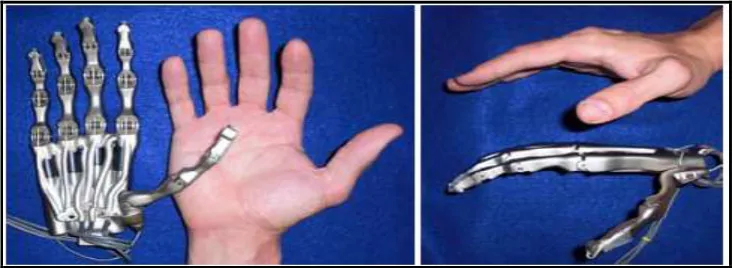Figure 2.5:  Design of bionic hand by W. Widhiada [5] 