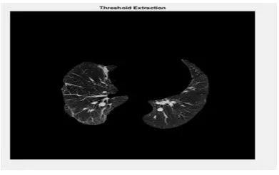 Fig 2.5 Threshold Extraction 