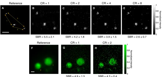 Fig. 2. Images of fluorescent microscopic samples through scattering phantoms. Fluorescent beads of 400 nm in diameter and fixed HEK293T/17-GFP cells were