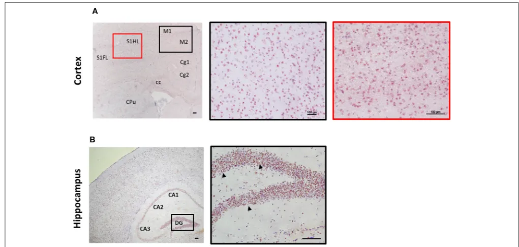 FIGURE 3 | Expression of ST2 in mouse brain regions. Brains from C57BL/6 mice were sectioned coronally and stained for the expression of ST2 (red/brown) and