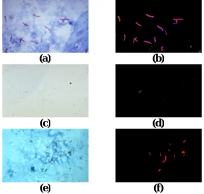 Fig. 6. Results of the contrast value restoration using  corrstretchde- function, (a), (c), and (e) are the original images 
