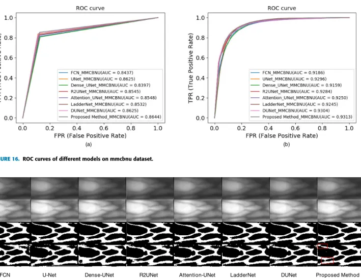 FIGURE 16. ROC curves of different models on mmcbnu dataset.