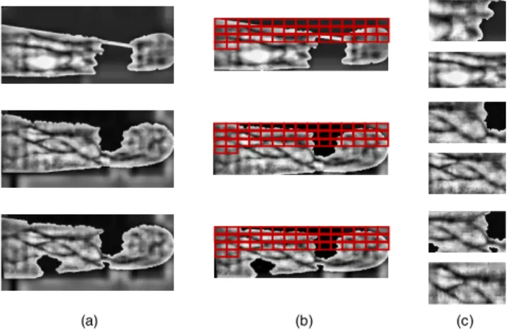 FIGURE 8. ROI extraction example of pixel missing images.