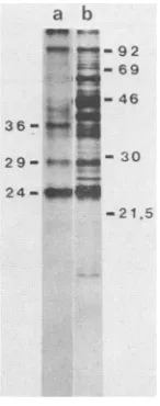 FIG. 7.partiallyTheas described Phosphopeptide analysis of fragments of LT generated by partial tryptic digestion