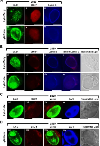 FIG 10 Distribution patterns of four EBV RNAs during lytic cycle of EBV infection: EBER-1 (a short noncoding RNA), BMRF1(an early lytic mRNA), and BBRF1 and BcLF1 (two late lytic mRNAs)