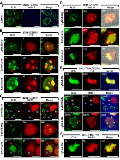 FIG 2 Nuclear reorganization during lytic EBV infection is accompanied by dispersal of SC35 from IGCs, colocalization ofSC35 with BMLF1 and BGLF5 at virus-induced nodules on replication compartments (VINORCs) and redistribution of SC35to viral replication 