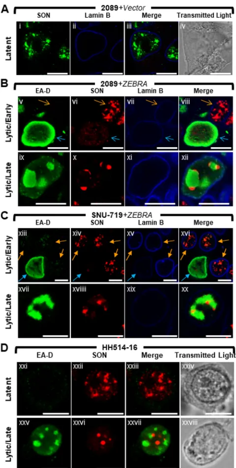 FIG 3 The cellular splicing factor SON is redistributed to nodular structures at the periphery of viralreplication compartments during lytic EBV replication