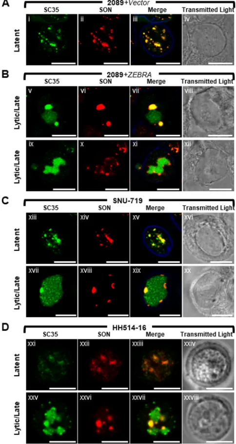 FIG 4 SON colocalizes with SC35 in VINORCs. SC35, but not SON, is recruited to viral replicationcompartments