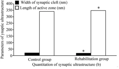 Figure 4. Peak latency of population spike for the rehabilitation group after cognition tests got short-er comparing with that before physical exercise (*P<0.05)