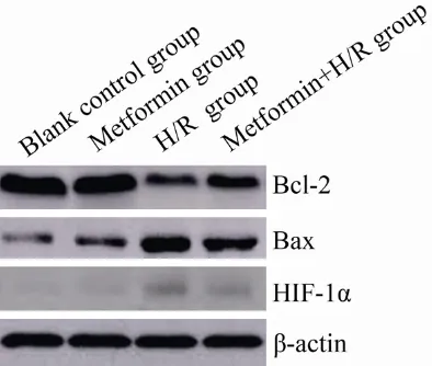 Table 2. Comparison of Bcl-2 and Bax protein expression in primary rat myocardial cells in each group