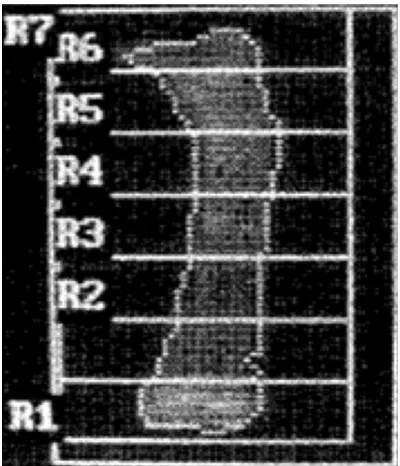 Figure 1. Analysis of isolated tibia in rats by DXA measurements.