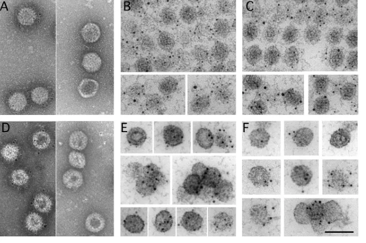 FIG 5 Immunogold labeling of pVP2/VP2 and VP3 on the outer and inner surfaces of E1 and E5 T�13 capsids