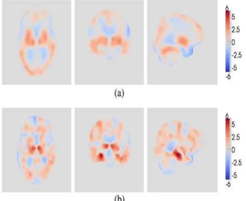 Fig. 8.    Visualizations showing regions of significant ( visualizations, (b) and (d), show the av- (c), depict significant regions of voxel-wise significance (red) and group-wise comparing results from (a) and (b) registration to (c) and (d) multistructu
