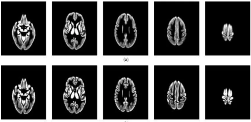 Fig.3.    Average T1 MRI images from groupwise registration of all subjects in the OASIS database (150  whether the anatomical features are sharp (high accuracy) or blurred (low accuracy)