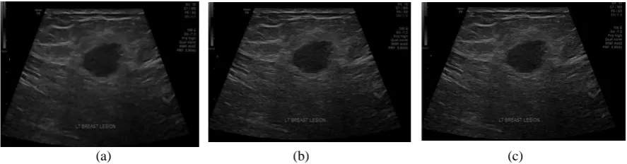 Figure 2. Ultrasound Input image  